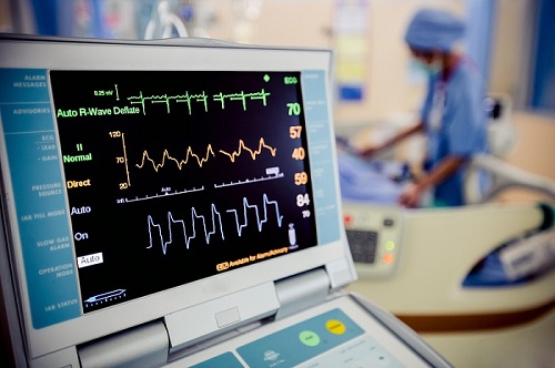 EKG Machine Monitor EKG Machine Monitor